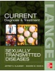 Current Diagnosis and Treatment of Sexually