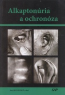 Alkaptonúria a ochronóza (Jozef Rovenský)