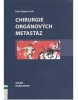 Chirurgie orgánových metastáz (Ivan Čapov)