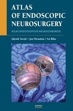 Atlas endoskopické neurochirurgie (Ivo Říha, Jan Chrastina)