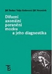 Difuzní axonální poranění mozku a jeho diagnostika (Jiří Štefan, Valja  Kellerová, Jiří Neuwirth)