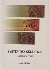 Systémová skleróza - sklerodermia (Jozef Lukáč)