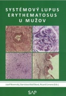 Systemovy lupus erythematosus u muzov (Ricard Cervera, Stanislava Blažičková, Jozef Rovenský)