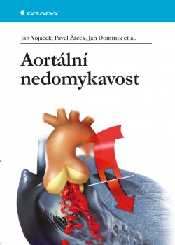 Aortální nedomykavost (Pavel Žáček, Jan Dominik, kolektív, Jan Vojáček)