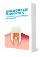 Etiopatogeneze parodontitid a jejich vztah k systémovým onemocněním (Michal Straka)